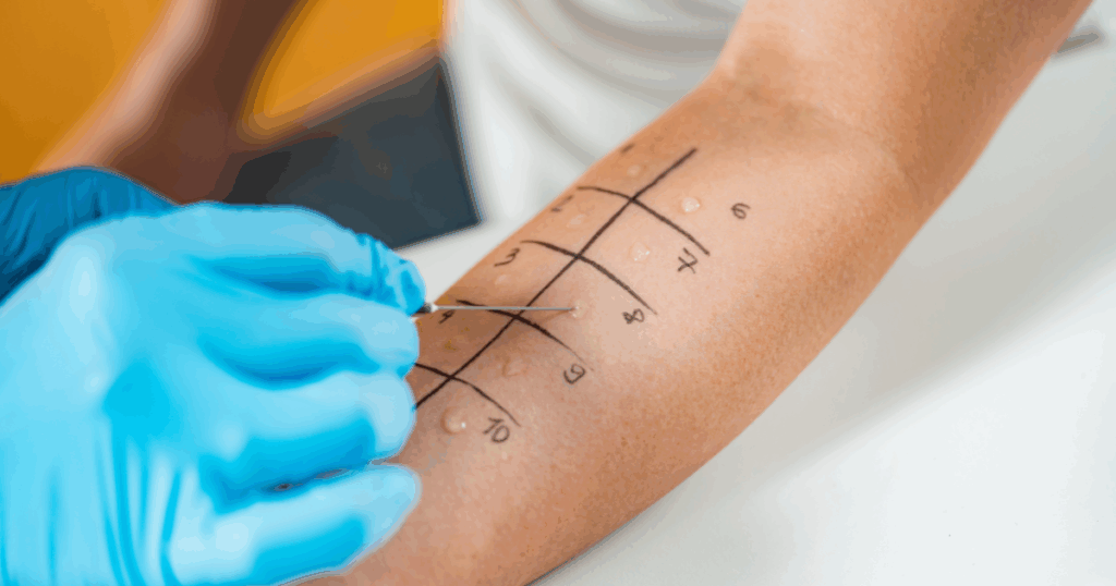 O que é uma alergia?